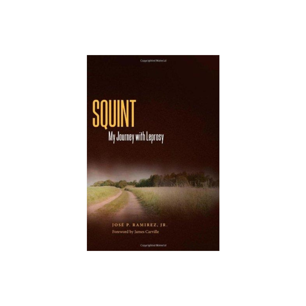 Produktbild för Squint (inbunden, eng)