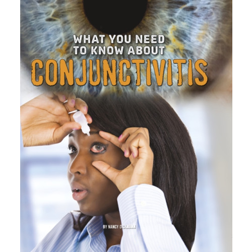 Capstone Global Library Ltd What You Need to Know about Conjunctivitis (inbunden, eng)