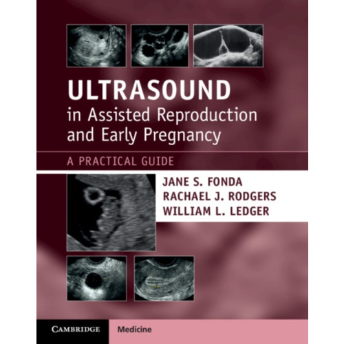 Cambridge University Press Ultrasound in Assisted Reproduction and Early Pregnancy (häftad, eng)