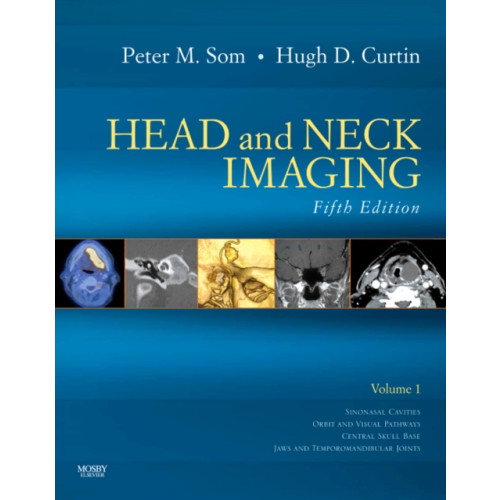 Elsevier - Health Sciences Division Head and Neck Imaging - 2 Volume Set (inbunden, eng)