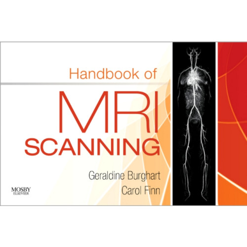 Elsevier - Health Sciences Division Handbook of MRI Scanning (häftad, eng)