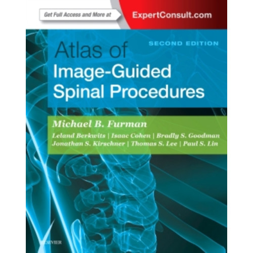 Elsevier - Health Sciences Division Atlas of Image-Guided Spinal Procedures (inbunden, eng)