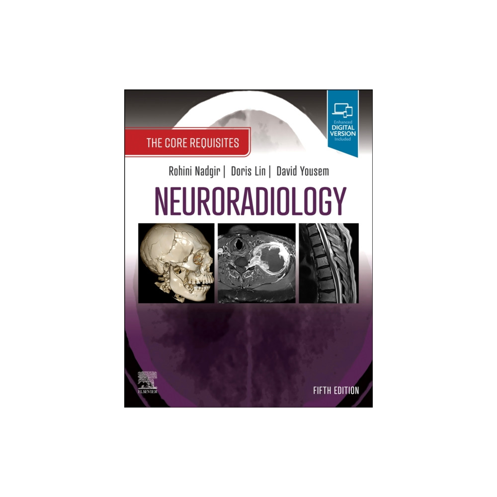 Produktbild för Neuroradiology (häftad, eng)