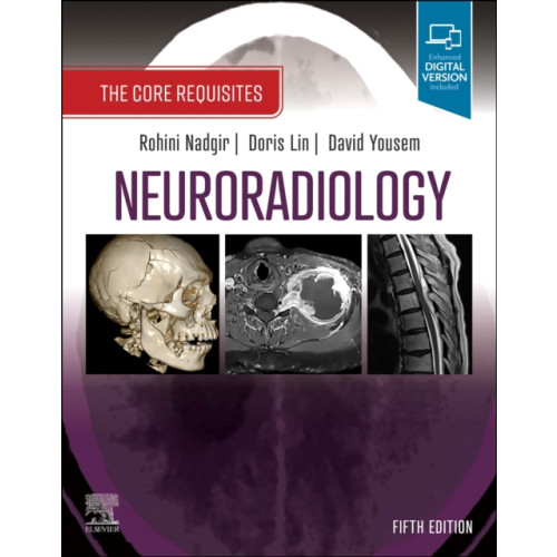 Elsevier - Health Sciences Division Neuroradiology (häftad, eng)