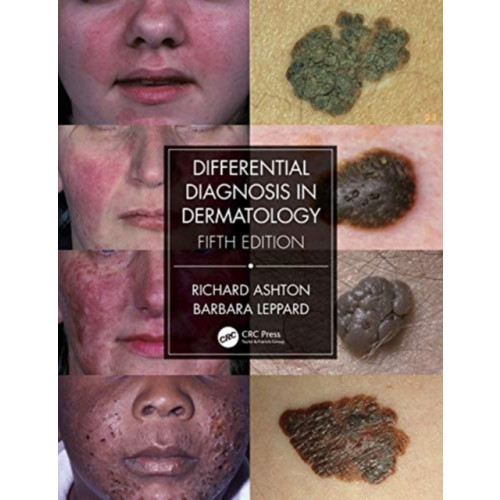 Taylor & francis ltd Differential Diagnosis in Dermatology (häftad, eng)