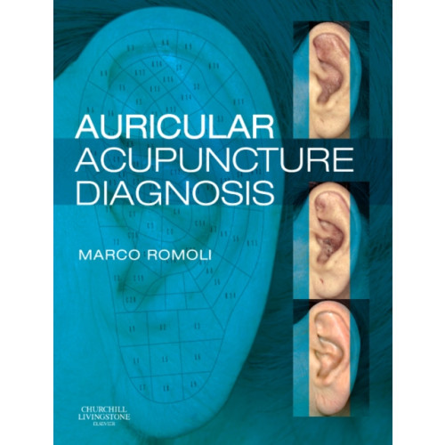 Elsevier Health Sciences Auricular Acupuncture Diagnosis (inbunden, eng)