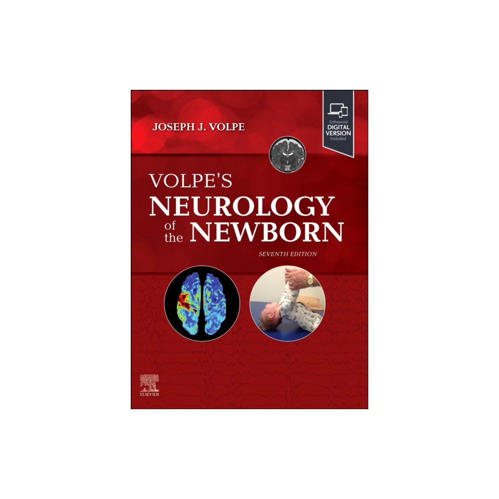Produktbild för Volpe's Neurology of the Newborn (inbunden, eng)