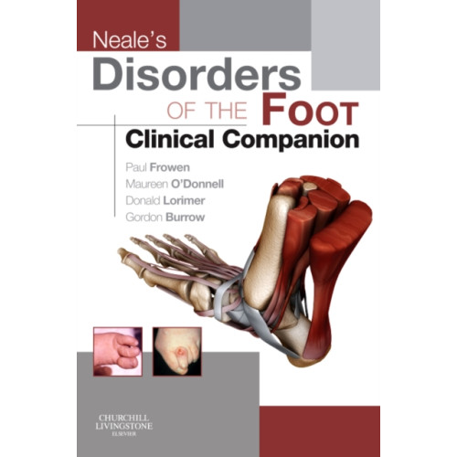 Elsevier Health Sciences Neale's Disorders of the Foot Clinical Companion (häftad, eng)