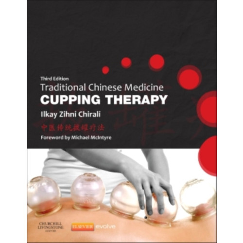 Elsevier Health Sciences Traditional Chinese Medicine Cupping Therapy (häftad, eng)