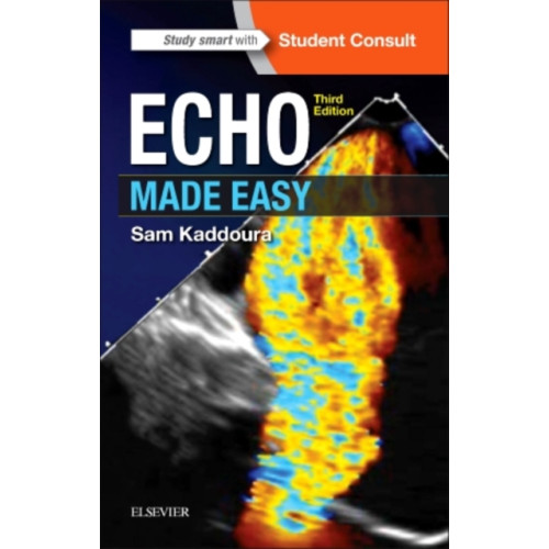 Elsevier Health Sciences Echo Made Easy (häftad, eng)