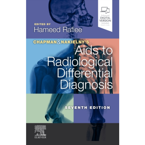 Elsevier Health Sciences Chapman & Nakielny's Aids to Radiological Differential Diagnosis (häftad, eng)