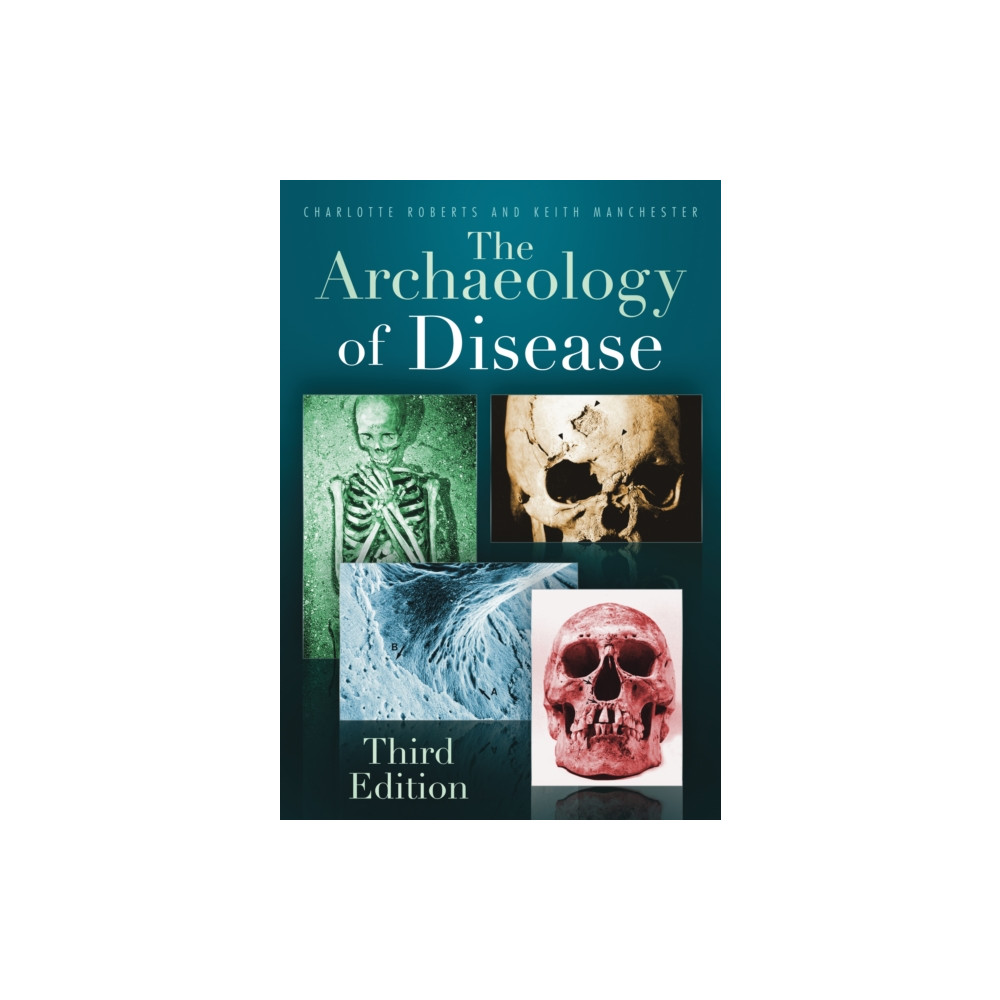 Produktbild för The Archaeology of Disease (häftad, eng)