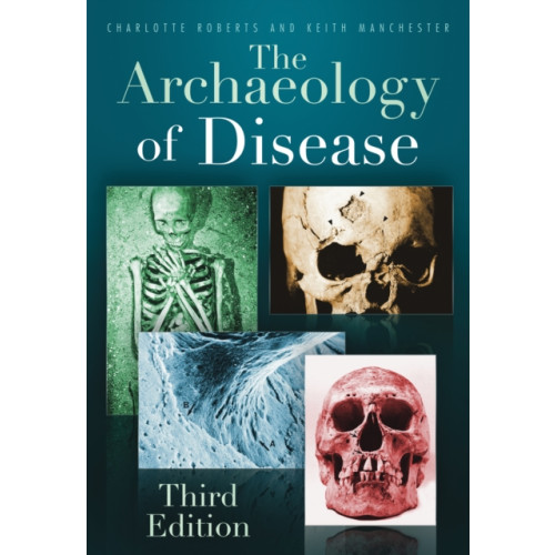 The History Press Ltd The Archaeology of Disease (häftad, eng)