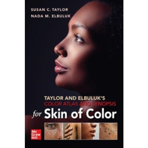 McGraw-Hill Education Taylor and Elbuluk's Color Atlas and Synopsis for Skin of Color (häftad, eng)