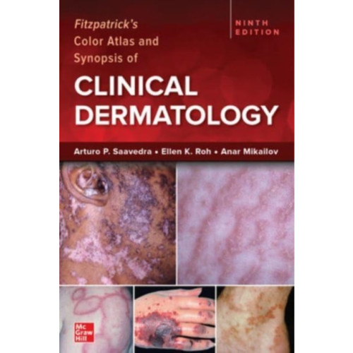 McGraw-Hill Education Fitzpatrick's Color Atlas and Synopsis of Clinical Dermatology, Ninth Edition (häftad, eng)