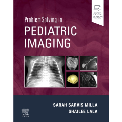 Elsevier - Health Sciences Division Problem Solving in Pediatric Imaging (inbunden, eng)