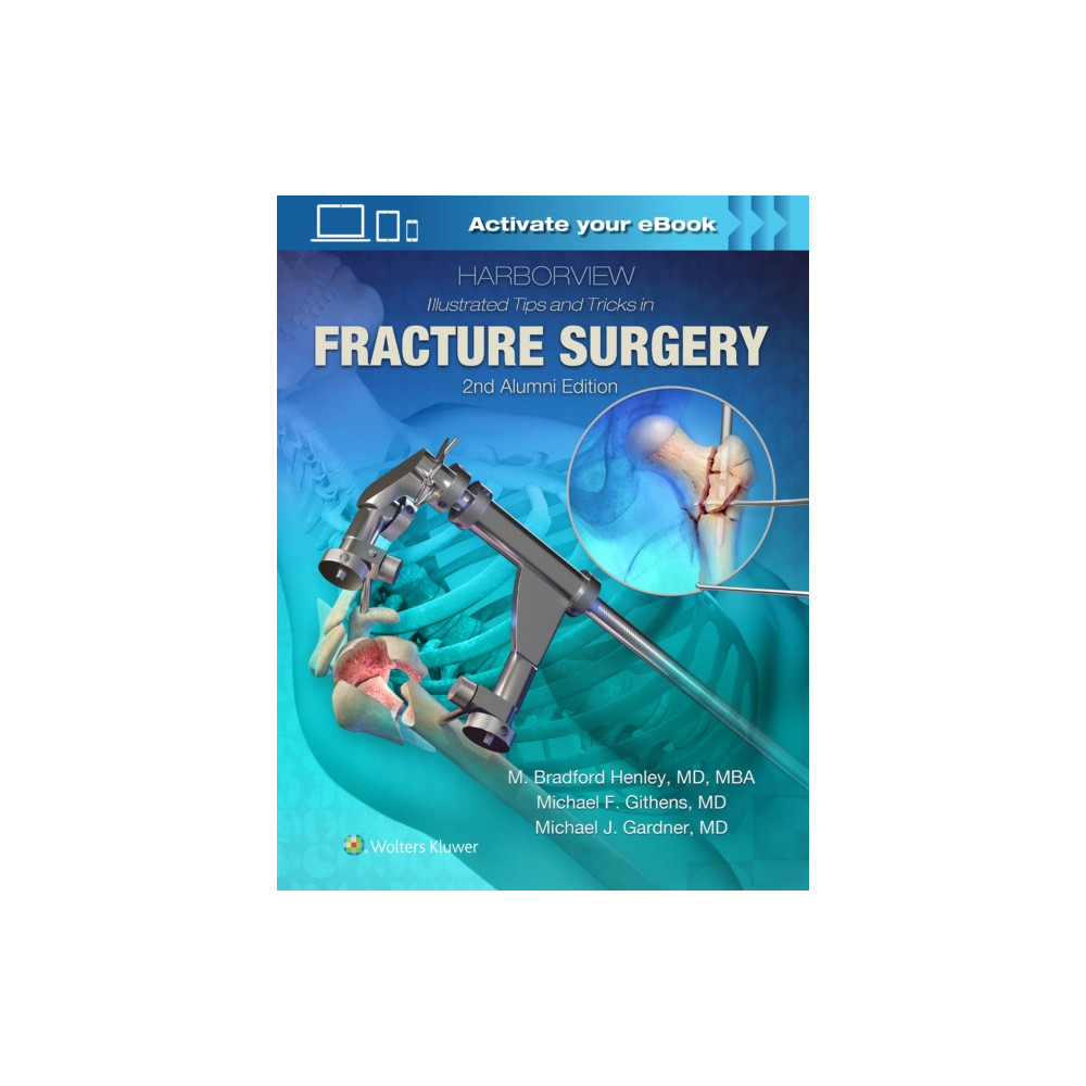 Produktbild för Harborview Illustrated Tips and Tricks in Fracture Surgery (inbunden, eng)