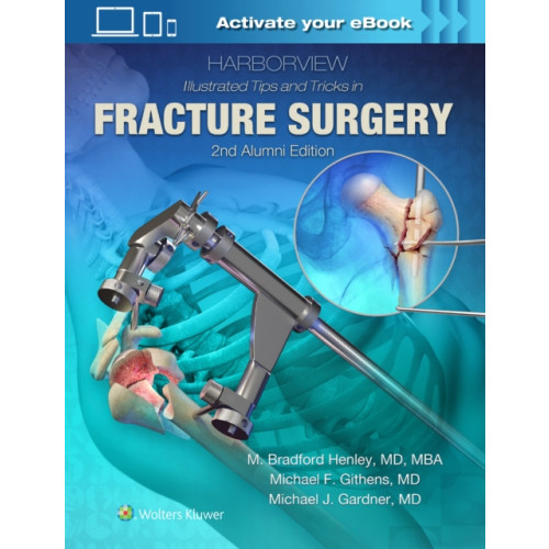 Lippincott Williams and Wilkins Harborview Illustrated Tips and Tricks in Fracture Surgery (inbunden, eng)