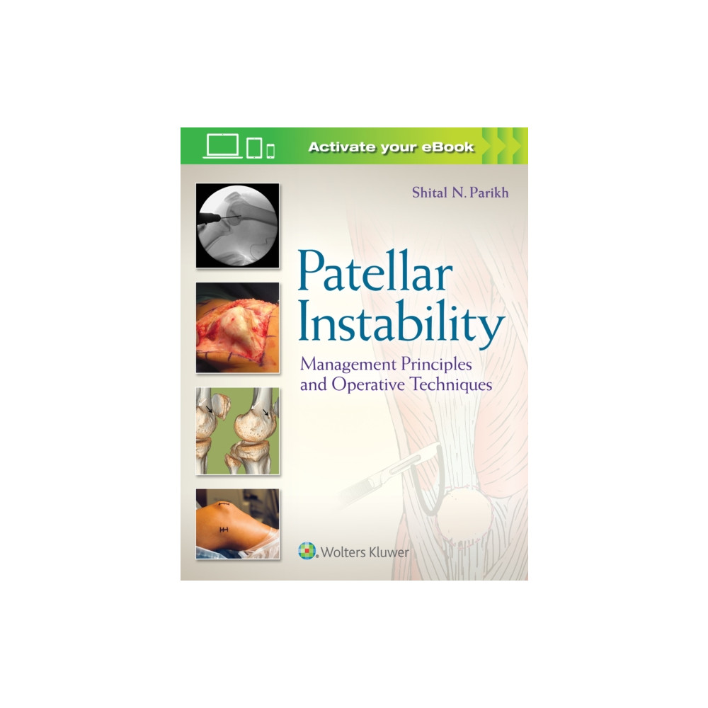 Produktbild för Patellar Instability (inbunden, eng)