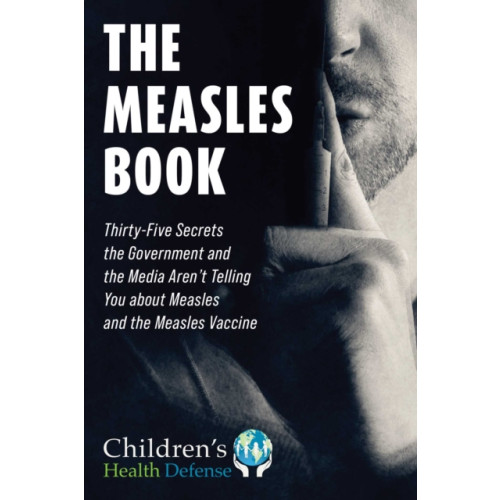 Skyhorse Measles Book (inbunden, eng)