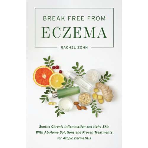 Ulysses Press Break Free From Eczema (häftad, eng)