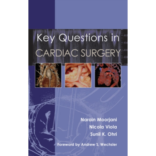 TFM Publishing Ltd Key Questions in Cardiac Surgery (häftad, eng)