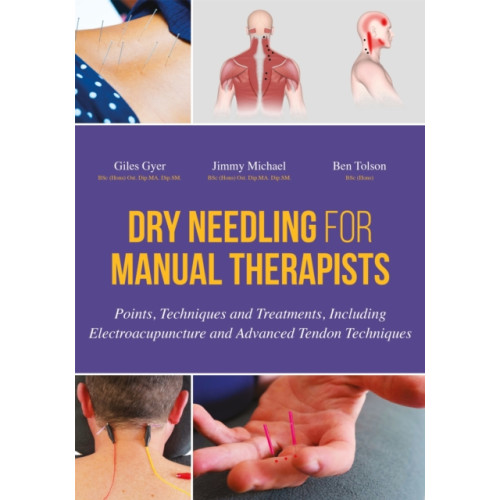 Jessica kingsley publishers Dry Needling for Manual Therapists (inbunden, eng)