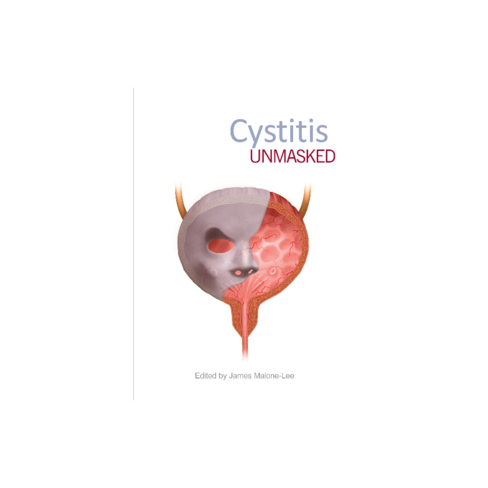 Produktbild för Cystitis Unmasked (häftad, eng)