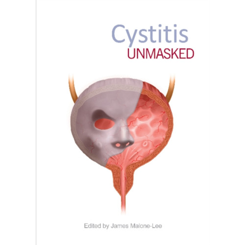 TFM Publishing Ltd Cystitis Unmasked (häftad, eng)