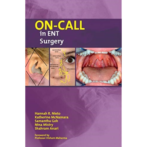 Libri Publishing On-Call in ENT Surgery (häftad, eng)