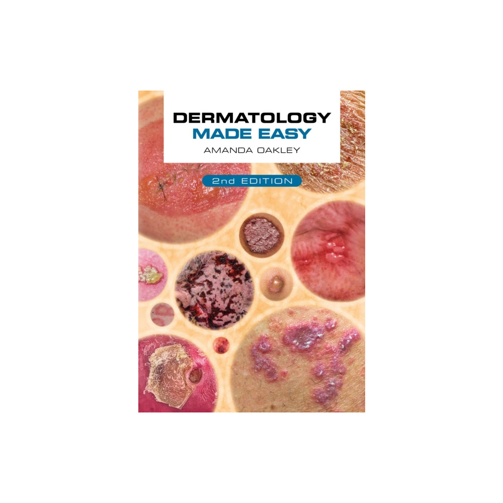 Produktbild för Dermatology Made Easy, second edition (häftad, eng)