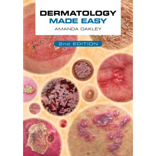 Scion Publishing Ltd Dermatology Made Easy, second edition (häftad, eng)