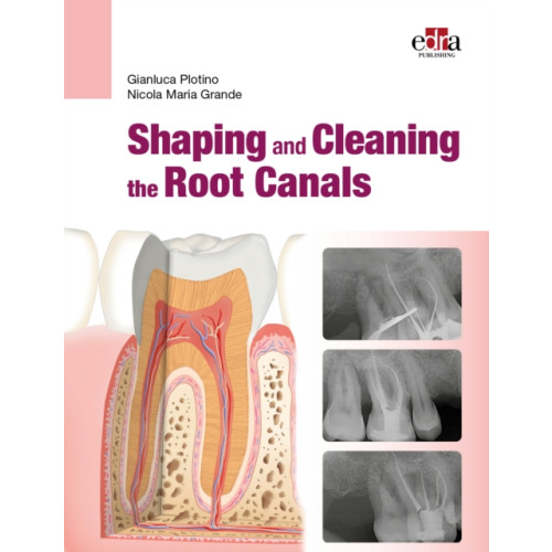 Edra Publishing US LLC Shaping and Cleaning the Root Canal System (häftad, eng)