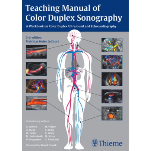 Thieme Publishing Group Teaching Manual of Color Duplex Sonography (häftad, eng)