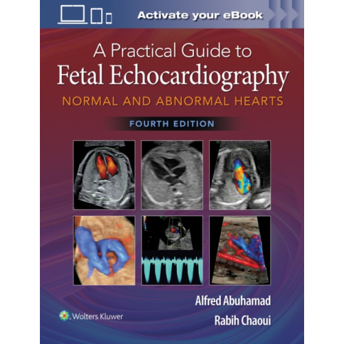 Wolters Kluwer Health A Practical Guide to Fetal Echocardiography (inbunden, eng)