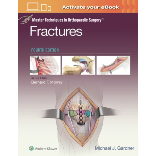 Wolters Kluwer Health Master Techniques in Orthopaedic Surgery: Fractures (inbunden, eng)