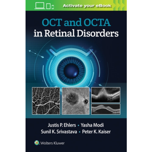 Wolters Kluwer Health OCT and OCTA in Retinal Disorders (häftad, eng)