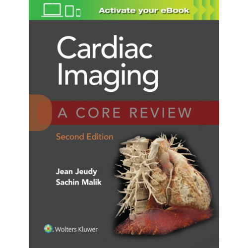 Wolters Kluwer Health Cardiac Imaging: A Core Review (häftad, eng)