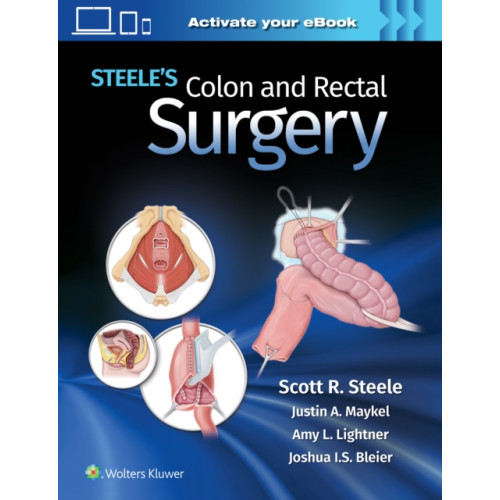 Wolters Kluwer Health Steele's Colon and Rectal Surgery (inbunden, eng)