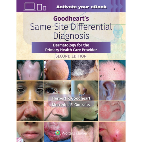 Wolters Kluwer Health Goodheart's Same-Site Differential Diagnosis (inbunden, eng)