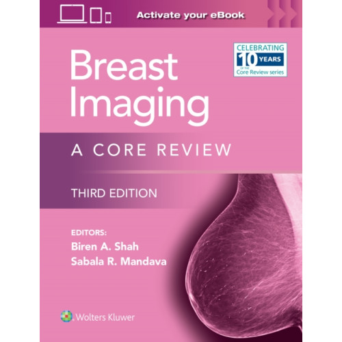 Wolters Kluwer Health Breast Imaging (häftad, eng)