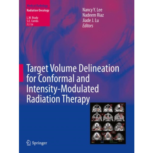 Springer International Publishing AG Target Volume Delineation for Conformal and Intensity-Modulated Radiation Therapy (inbunden, eng)