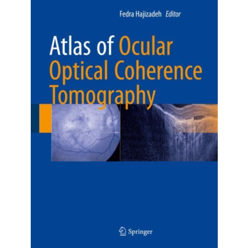 Springer International Publishing AG Atlas of Ocular Optical Coherence Tomography (inbunden, eng)