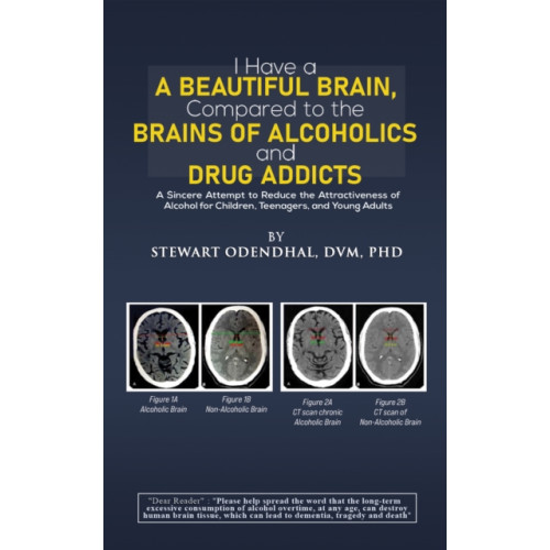 Austin Macauley Publishers LLC I Have a Beautiful Brain, Compared to the Brains of Alcoholics and Drug Addicts (häftad, eng)