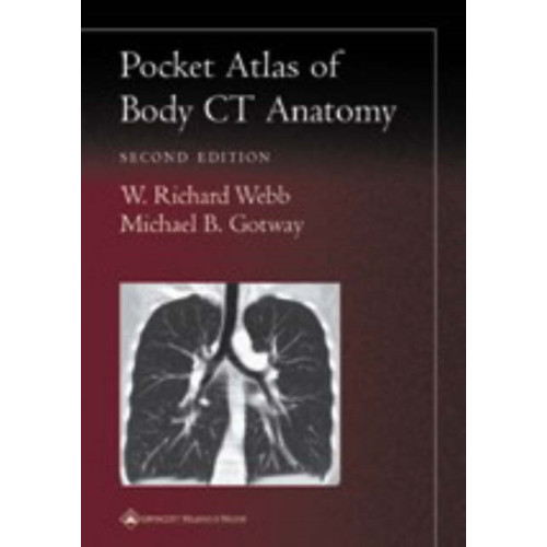 Lippincott Williams and Wilkins Pocket Atlas of Body CT Anatomy (häftad, eng)