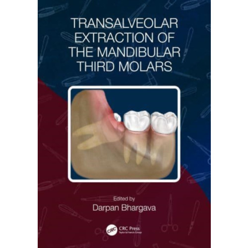 Taylor & francis ltd Transalveolar Extraction of the Mandibular Third Molars (häftad, eng)