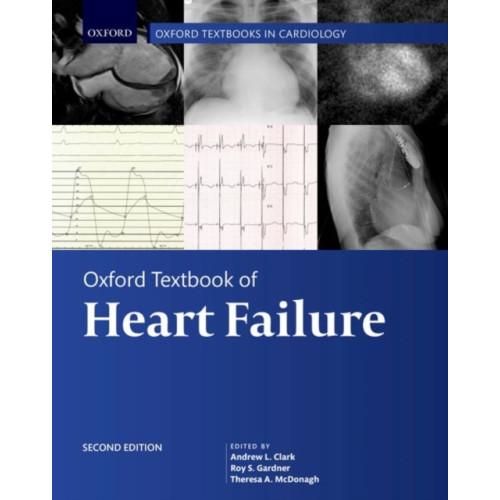 Oxford University Press Oxford Textbook of Heart Failure (inbunden, eng)
