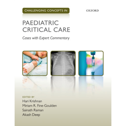 Oxford University Press Challenging Concepts in Paediatric Critical Care (häftad, eng)