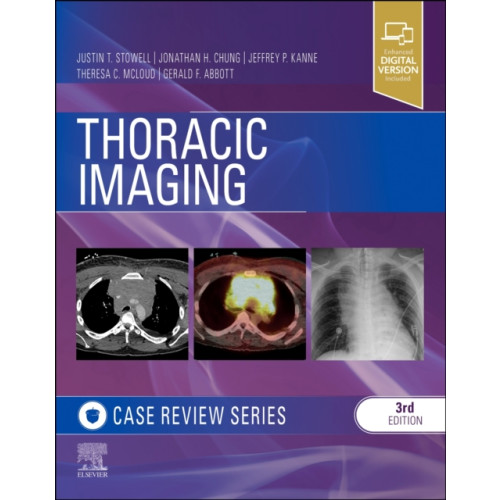 Elsevier - Health Sciences Division Thoracic Imaging: Case Review (häftad, eng)
