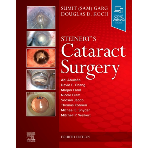 Elsevier - Health Sciences Division Steinert's Cataract Surgery (inbunden, eng)